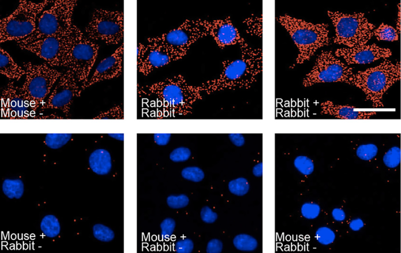 In situ detection of the eIF4F translation initiation complex in mammalian cells and tissues